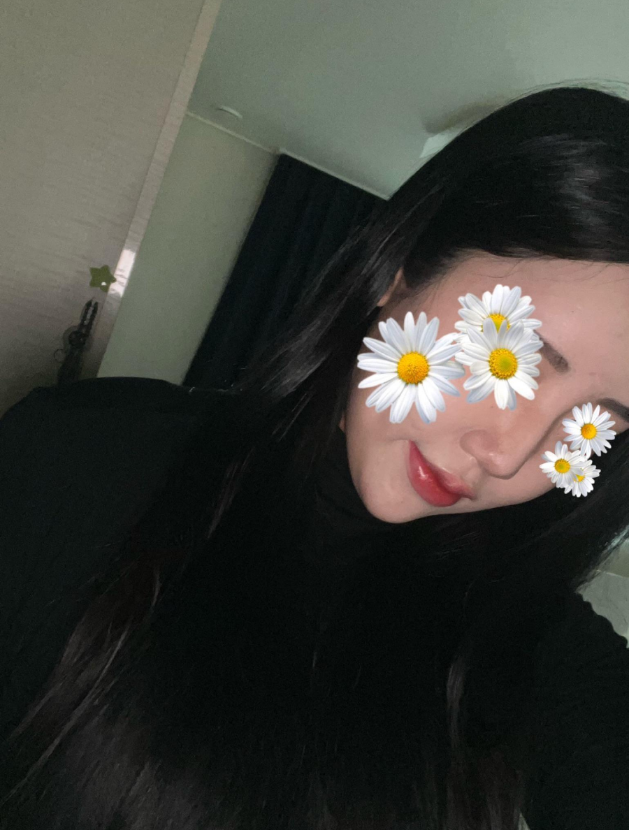 울퉁불퉁해 신경 쓰이던 코를 코원성형외과에서 낮은코와 매부리코교정으로 매끄럽게 만들었어요! 관련 이미지 4