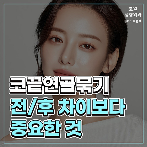 코끝 연골묶기 전후 단순히 모으는 변화보다 중요한 구조적 균형 관련 이미지 1