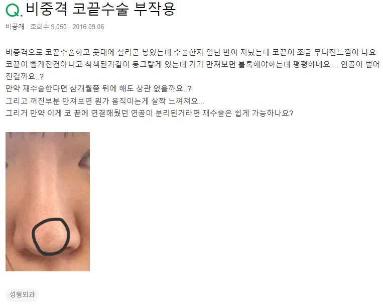 Q. I had septal tip surgery, and I suspect there may be a complication with the tip surgery image 2