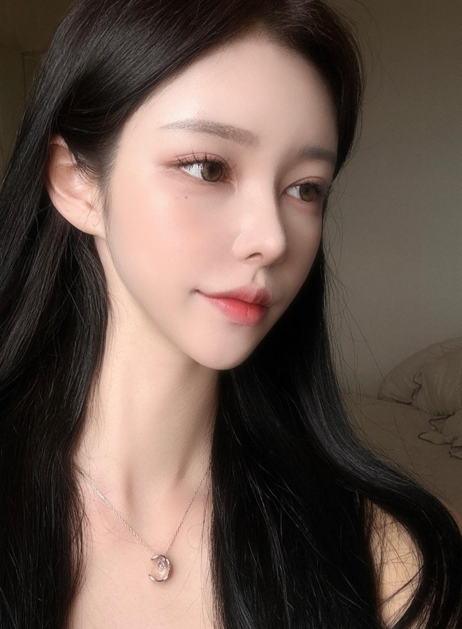 I successfully got the nose shape I wanted with 비순각 surgery and low-nose rhinoplasty! image 3