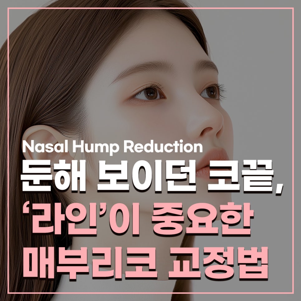매부리코 코끝수술로 완성하는 자연스럽고 세련된 라인 - 코원성형외과 관련 이미지 1