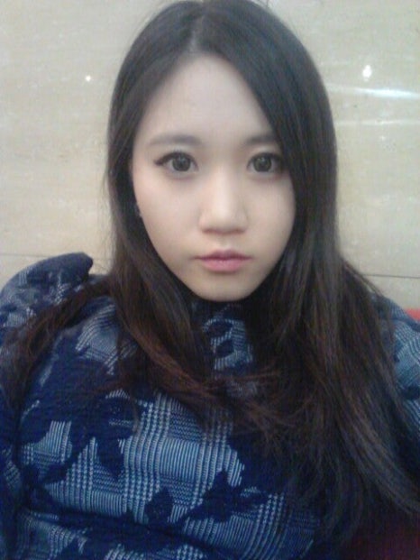 Q. 수술해도 퍼진코 코재수술로 작은코 되고 싶어요 관련 이미지 4