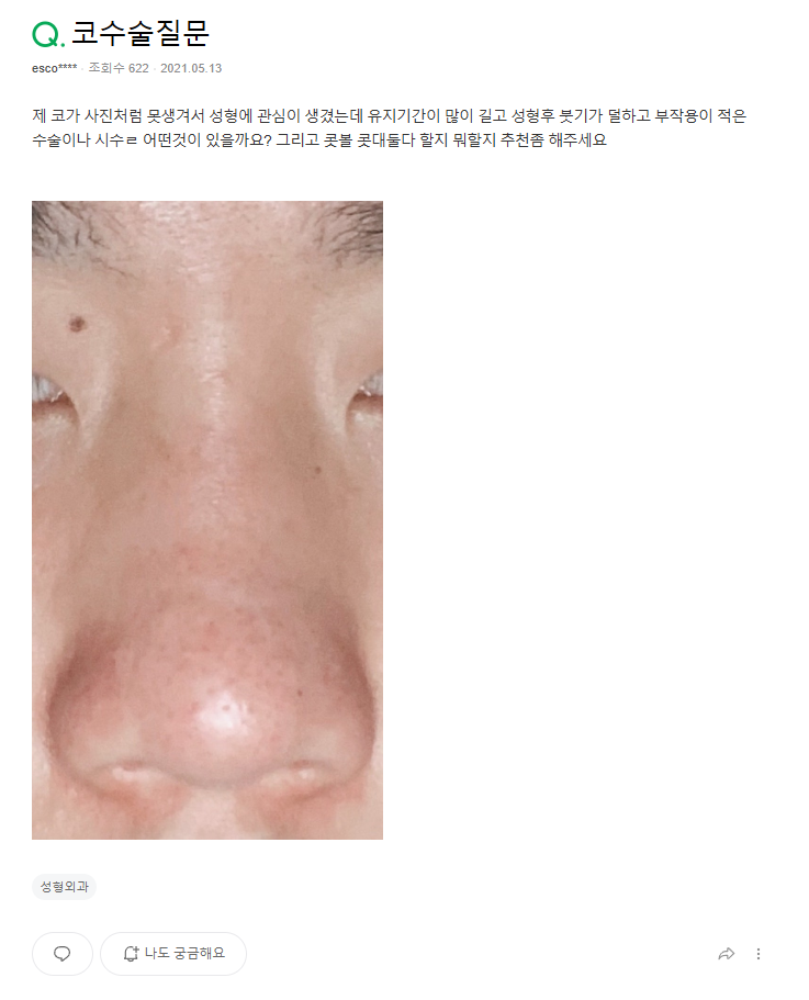 Q. I’m interested in male rhinoplasty and eye surgery—where is a good clinic for male nose surgery? image 2