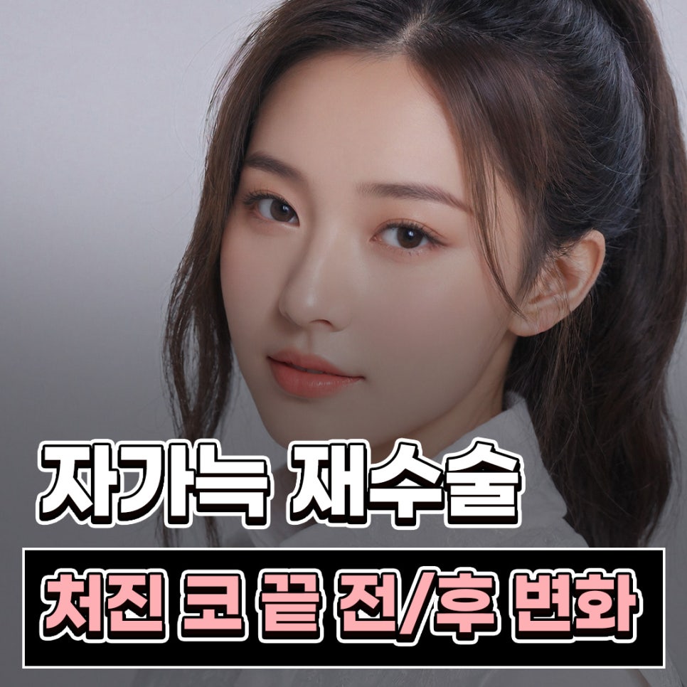 자가늑 코성형으로 코끝 처짐과 구조를 함께 고려해야 하는 이유 관련 이미지 1