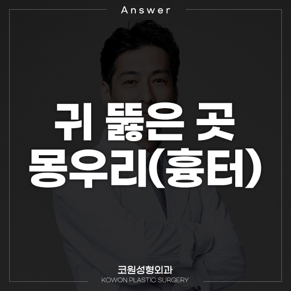 Q. 귀 뚫은 곳 몽우리, 귀켈로이드 때문에 고민이에요. 관련 이미지 1