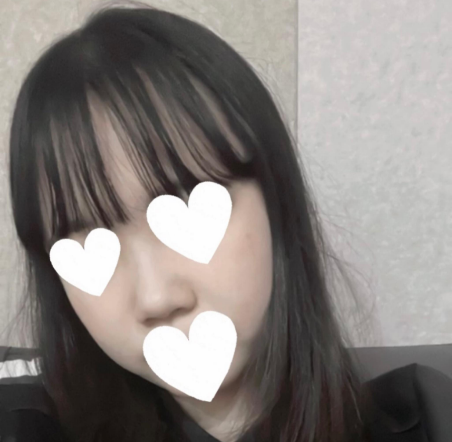 I Was Reborn with Small, Bulbous Nose Correction and Functional Nose Surgery for Deviated Septum at Kowon Plastic Surgery image 5