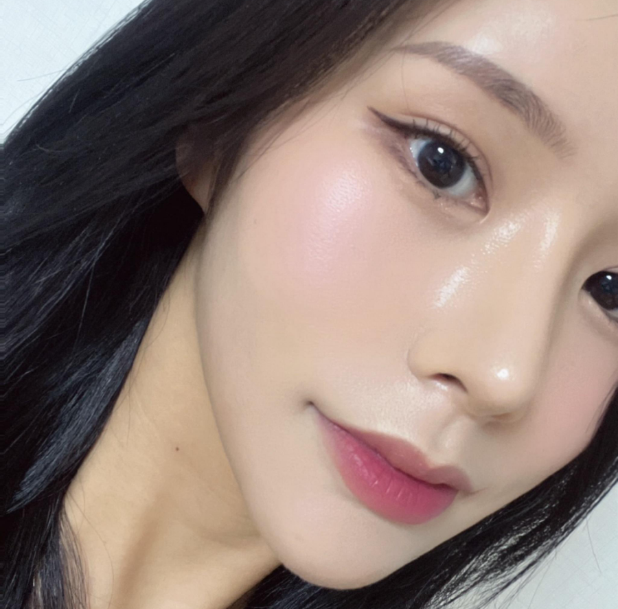과도하게 화려한코, 귀연골에 비중격코수술로 자연스럽게 개선 됐어요! 관련 이미지 3