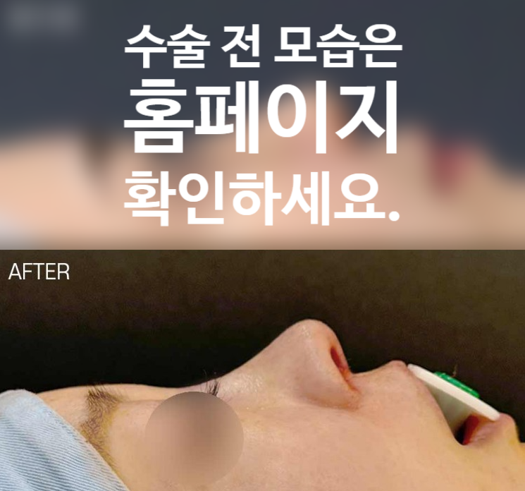 낮은코 성형 과하지 않은 높이와 부드러운 라인을 고려한 코원성형외과 사례 관련 이미지 2