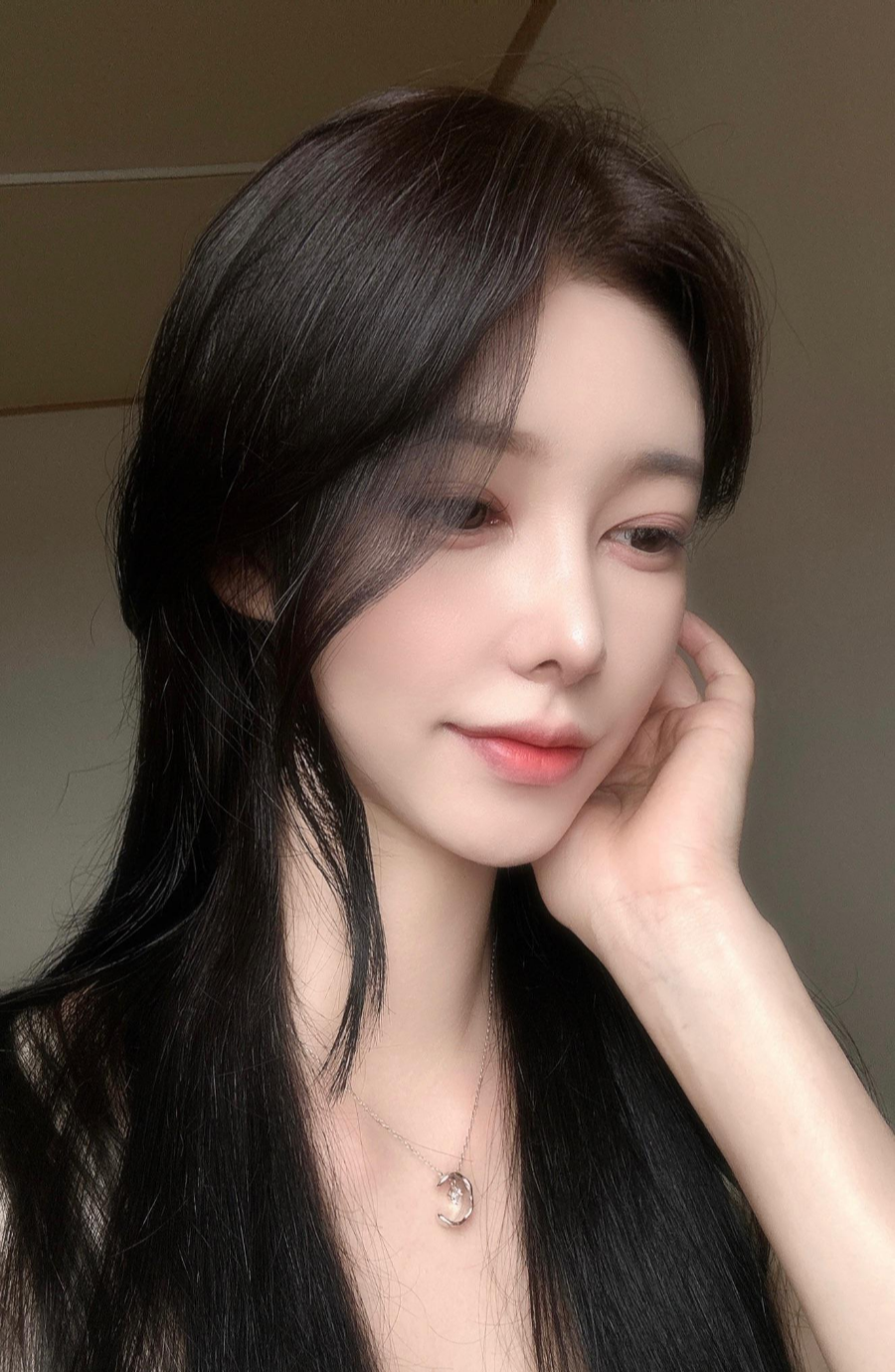 I successfully got the nose shape I wanted with 비순각 surgery and low-nose rhinoplasty! image 7