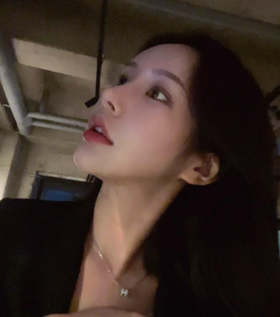 과도하게 화려한코, 귀연골에 비중격코수술로 자연스럽게 개선 됐어요! 관련 이미지 2