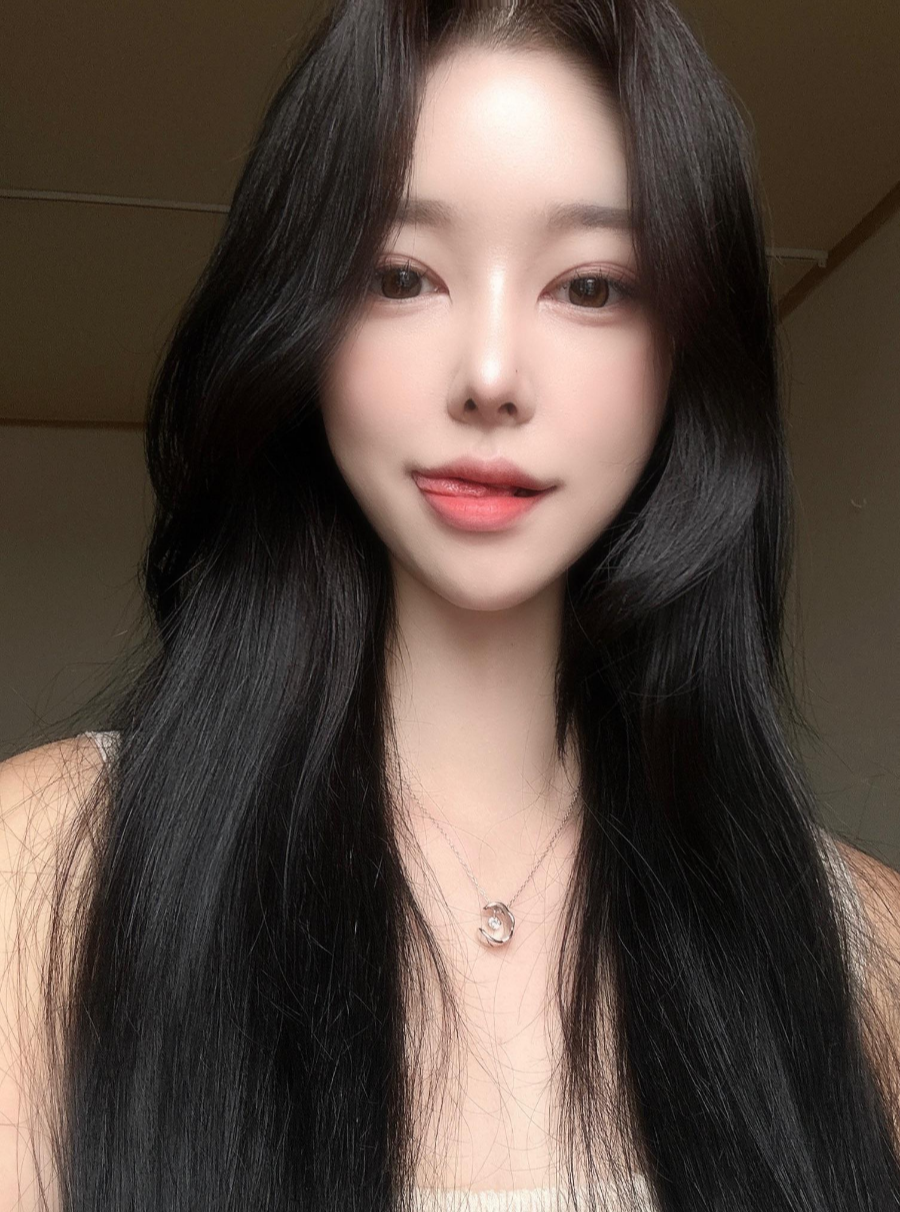 I successfully got the nose shape I wanted with 비순각 surgery and low-nose rhinoplasty! image 4