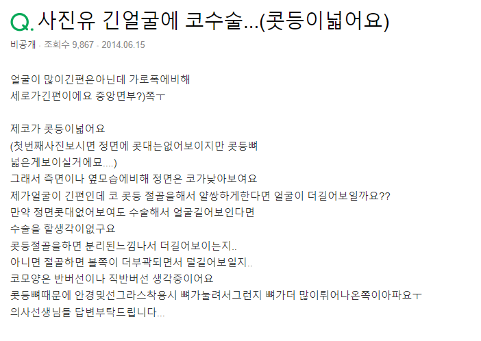Q. 넓은 콧등뼈 절골술, 얼굴 더 길어 보일까요? 관련 이미지 2
