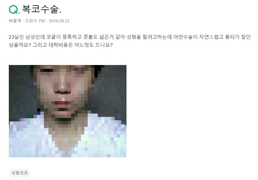 콧볼축소 수술하면 코수술흉터 남나요? feat. 남자복코수술 관련 이미지 2