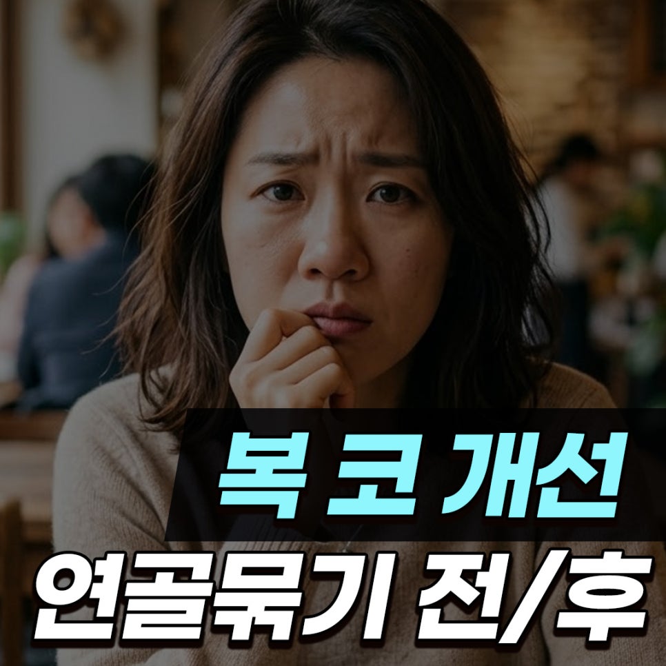 콧볼축소 연골묶기 병행으로 완성한 복코&middot;휜코 변화 과정 관련 이미지 1