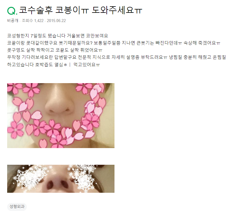 Q. 코붓기 때문에 코봉이로 보이는 거겠죠? 관련 이미지 2