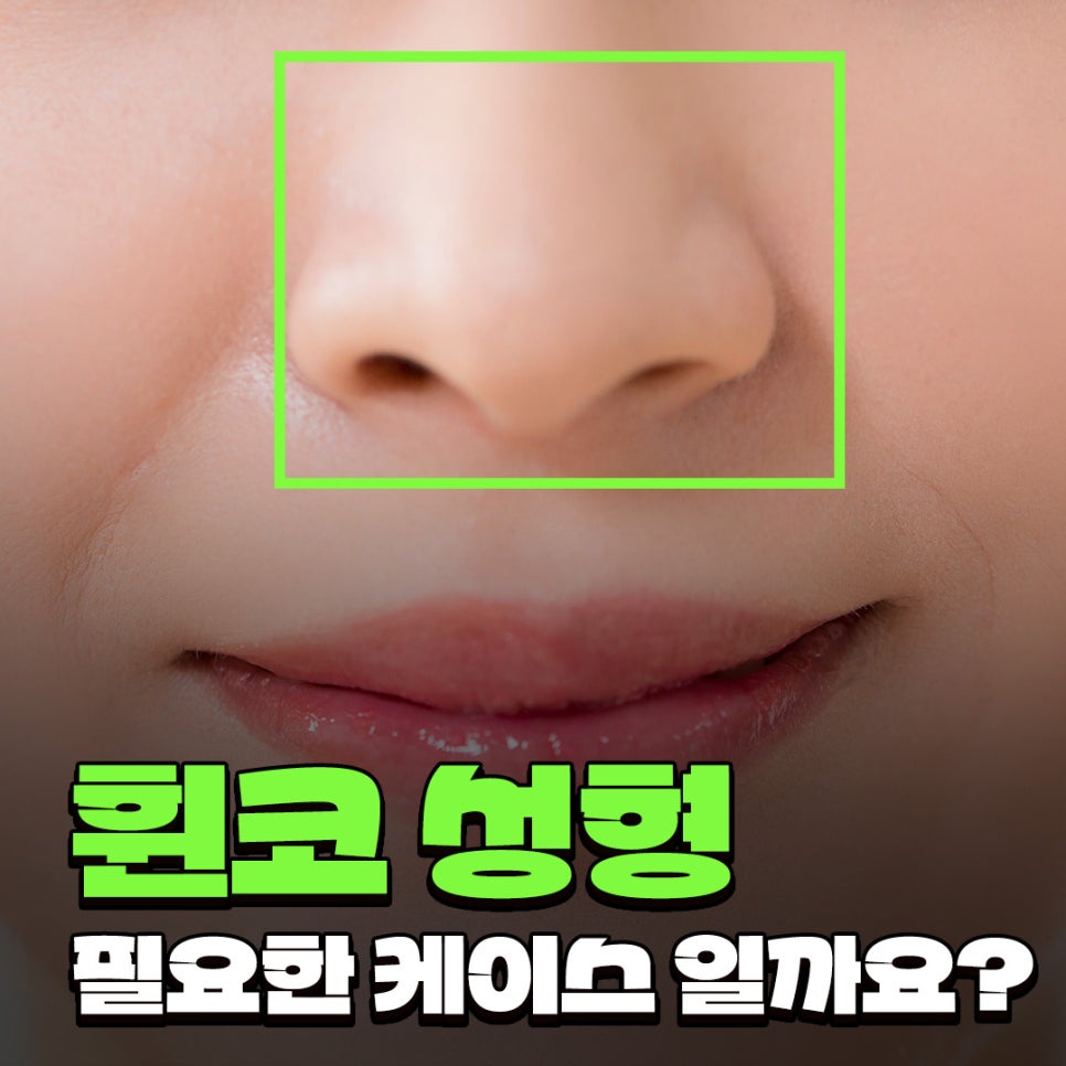 Q. Worried About Crooked Nose Surgery, What Nose Surgery Direction Should Be Considered Before Double Jaw Surgery image 1
