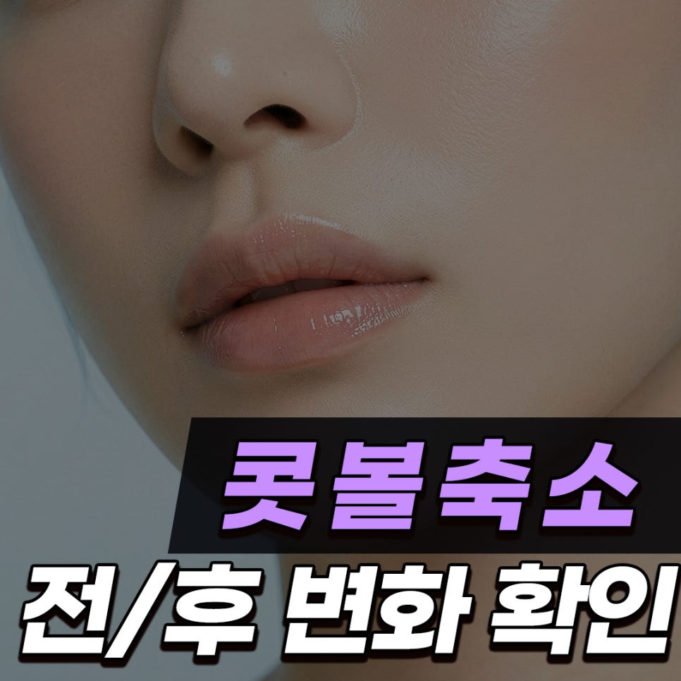 Q. 콧볼축소수술전후 변화가 클까요? 콧구멍 노출과 들린코 고민 정리 관련 이미지 1