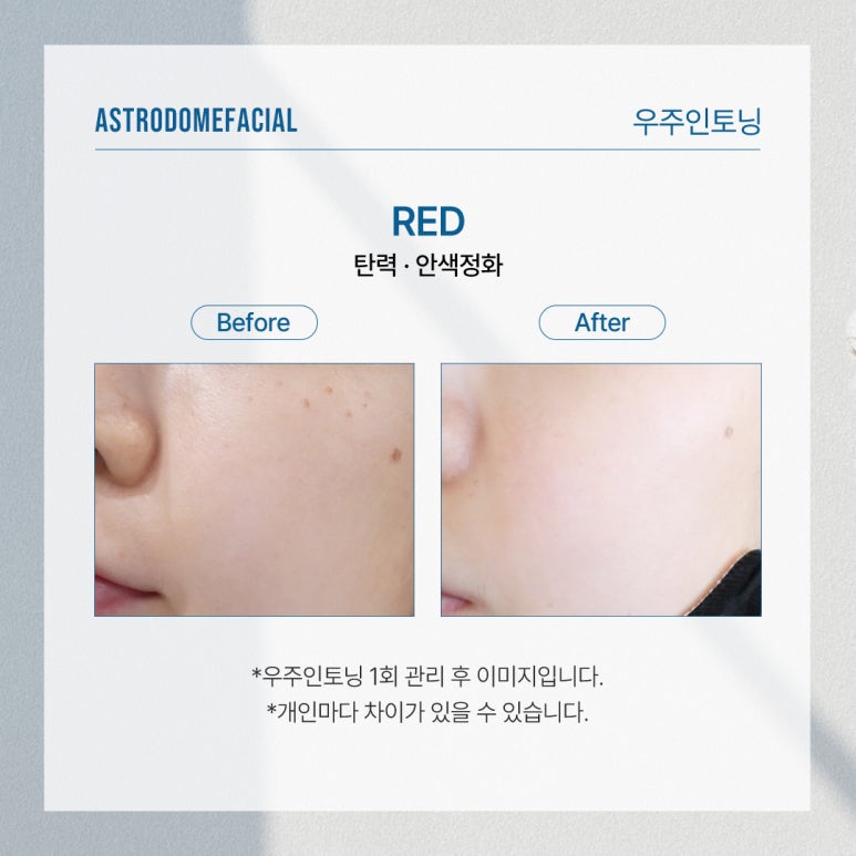 여름철 피지 모공 고민, 피부온도부터 낮춰야 합니다 : 닥터오 추천관리 관련 이미지 6