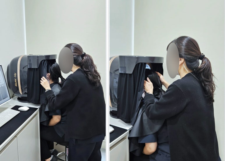 영등포 토닝의 효과, 과정, 시술 후 관리법 관련 이미지 3