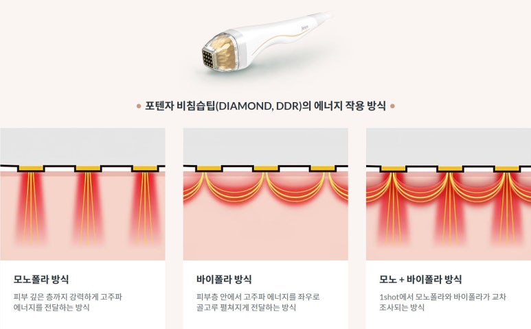 영등포 모공 고민, 포텐자가 해답입니다. 관련 이미지 5