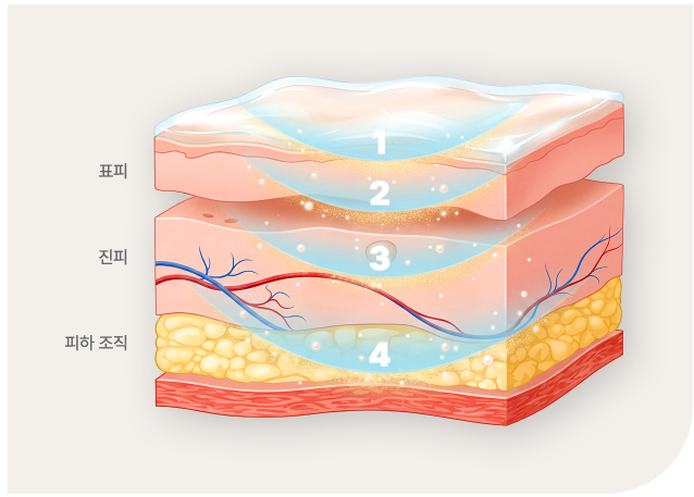 Painless Anesthesia, Multi-Layer Anesthesia for Pain Reduction image 1