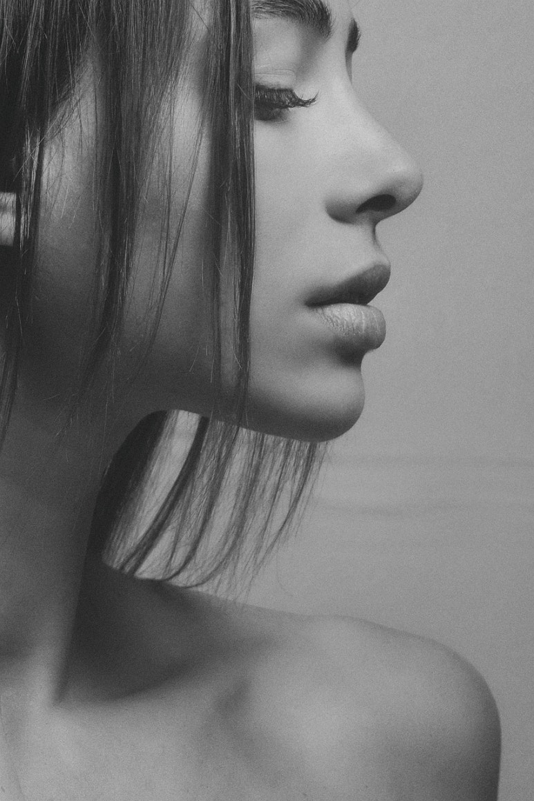 Yeongdeungpo Volnewmer Lifting, Refining Sagging Cheeks and the Jawline image 5