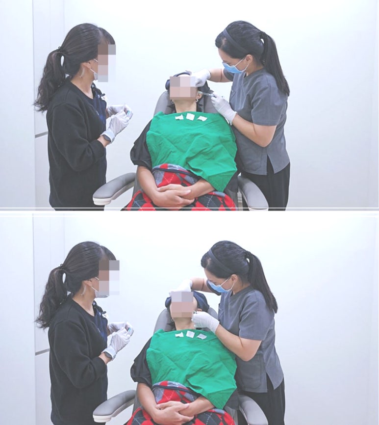 Yeongdeungpo Radiesse, the Secret to Collagen Stimulation image 3