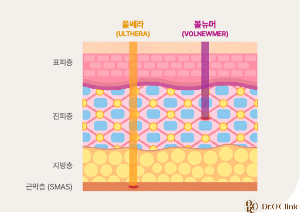 꾸준한 피부관리 시술을 찾으신다면?! 볼뉴머(VOLNEWMER) 관련 이미지 3