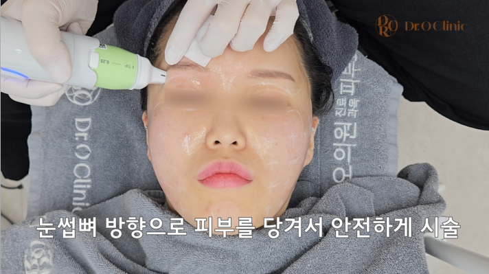 꾸준한 피부관리 시술을 찾으신다면?! 볼뉴머(VOLNEWMER) 관련 이미지 4