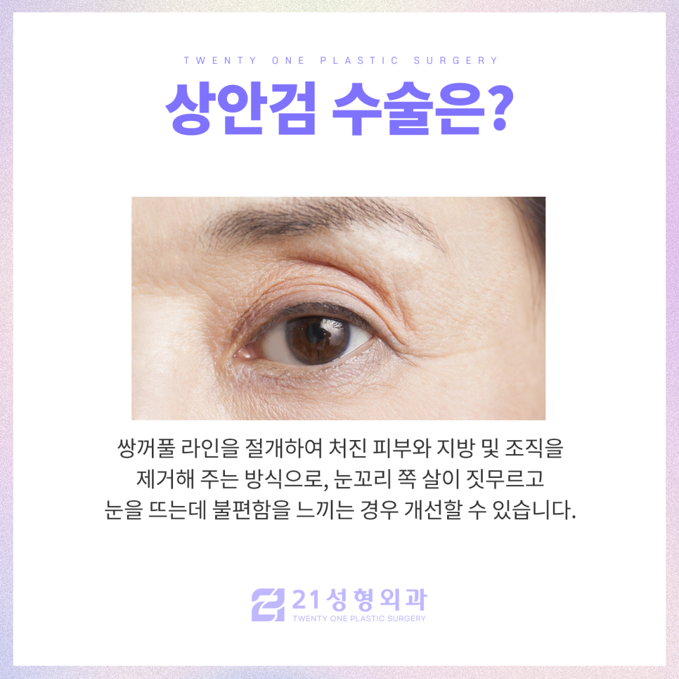 눈성형외과유명한곳 찾아볼 때 중요한 점은 관련 이미지 3