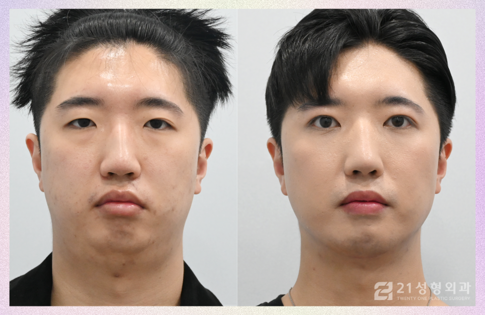 21성형외과에 사연을 들려주세요 관련 이미지 2
