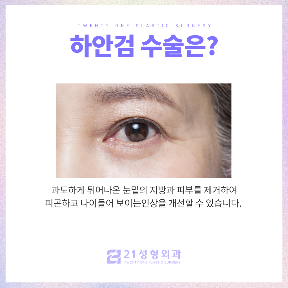 눈성형외과유명한곳 찾아볼 때 중요한 점은 관련 이미지 4