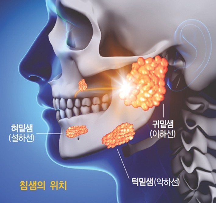 이중턱, 지방만 빼면 끝? 진짜 해결 방법과 실제 환자 전후 비교 관련 이미지 8