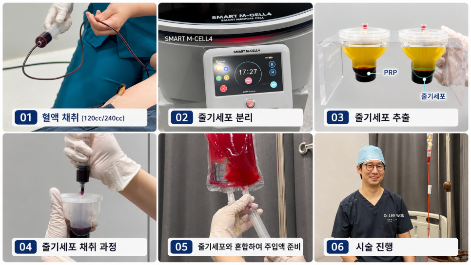 From Fat Reduction to Skin Regeneration: 21 Plastic Surgery’s Area-Specific Approach image 4