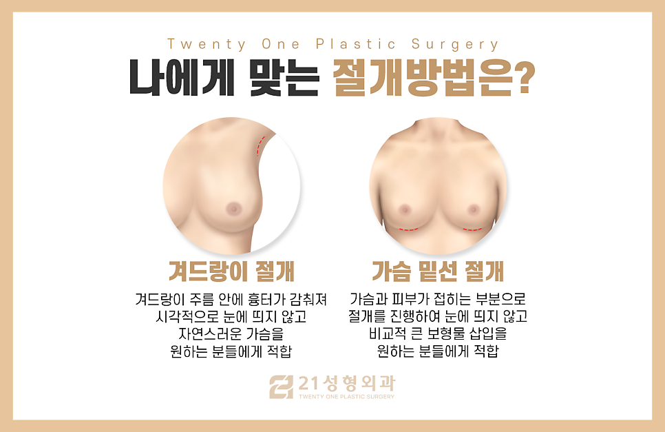 강남 가슴 성형외과 잘 찾기 위해선 이것만 확인하세요 관련 이미지 3