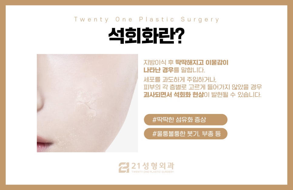 줄기세포지방이식과 일반 지방이식 중 최고의 선택은 관련 이미지 3
