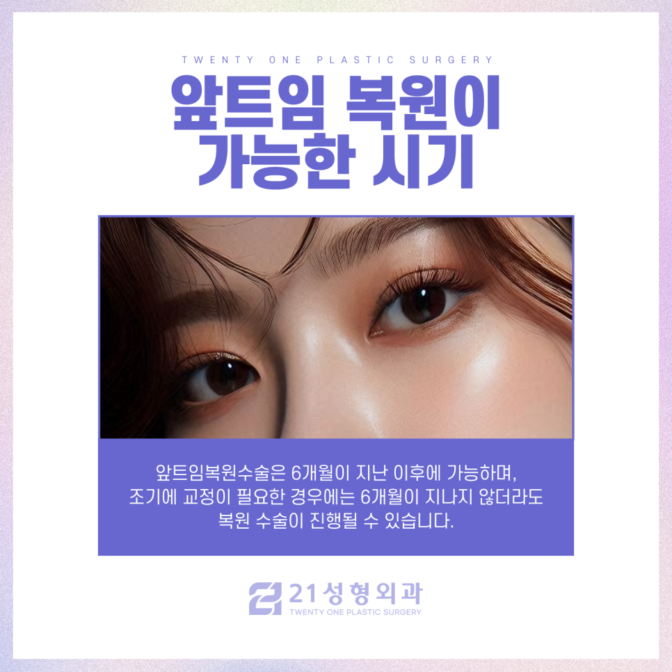 앞트임복원수술 자연스러운 눈매로 재탄생 관련 이미지 6