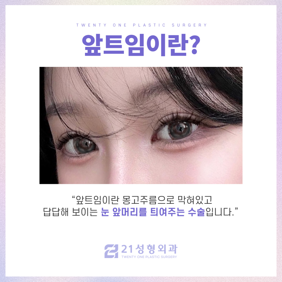 앞트임복원수술 자연스러운 눈매로 재탄생 관련 이미지 2