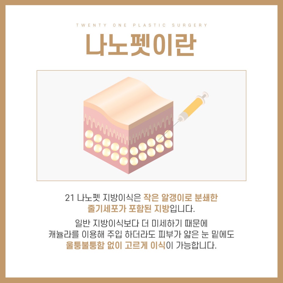 눈밑애교필러 대신 장원영 애교 만드는 쉬운 방법 관련 이미지 6