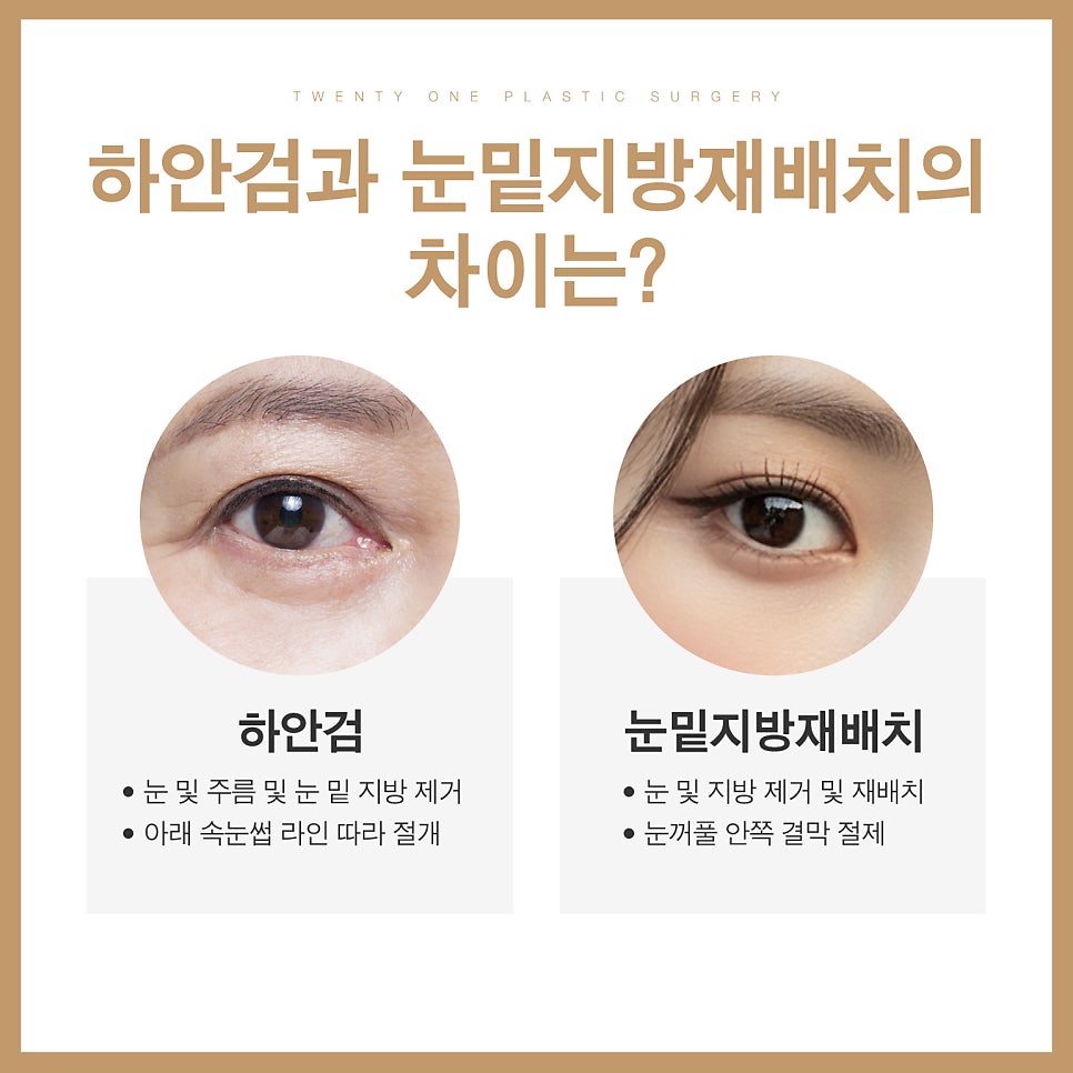 중년하안검 흉터 미리 방지 가능합니다 관련 이미지 4