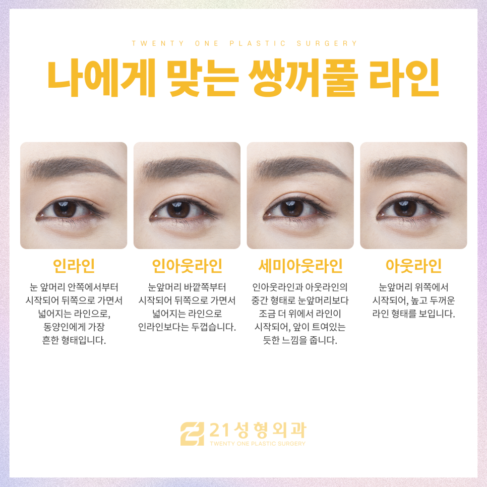 강남쌍꺼풀수술잘하는곳 찾아보는 포인트 관련 이미지 4