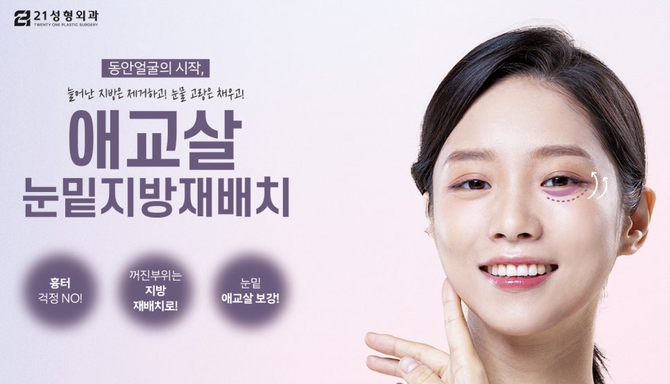 [지방재배치] 애교살 눈밑 지방 재배치는 어떤 경우 필요할까? [21성형 외과] 관련 이미지 1