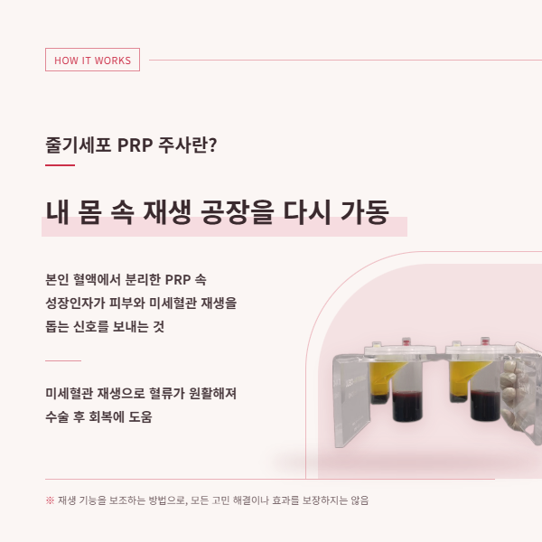 성형외과 원장도 직접 맞는다는 줄기세포 PRP 주사? 관련 이미지 2