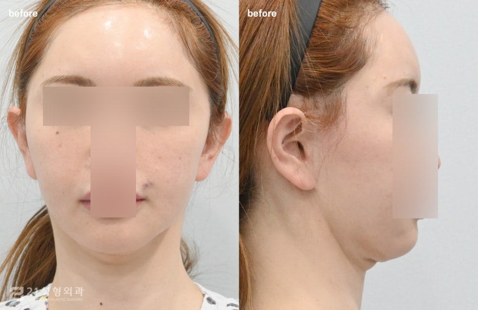 Is a Small Face and a Slim Face Shape Like Jennie’s Really Possible? image 2
