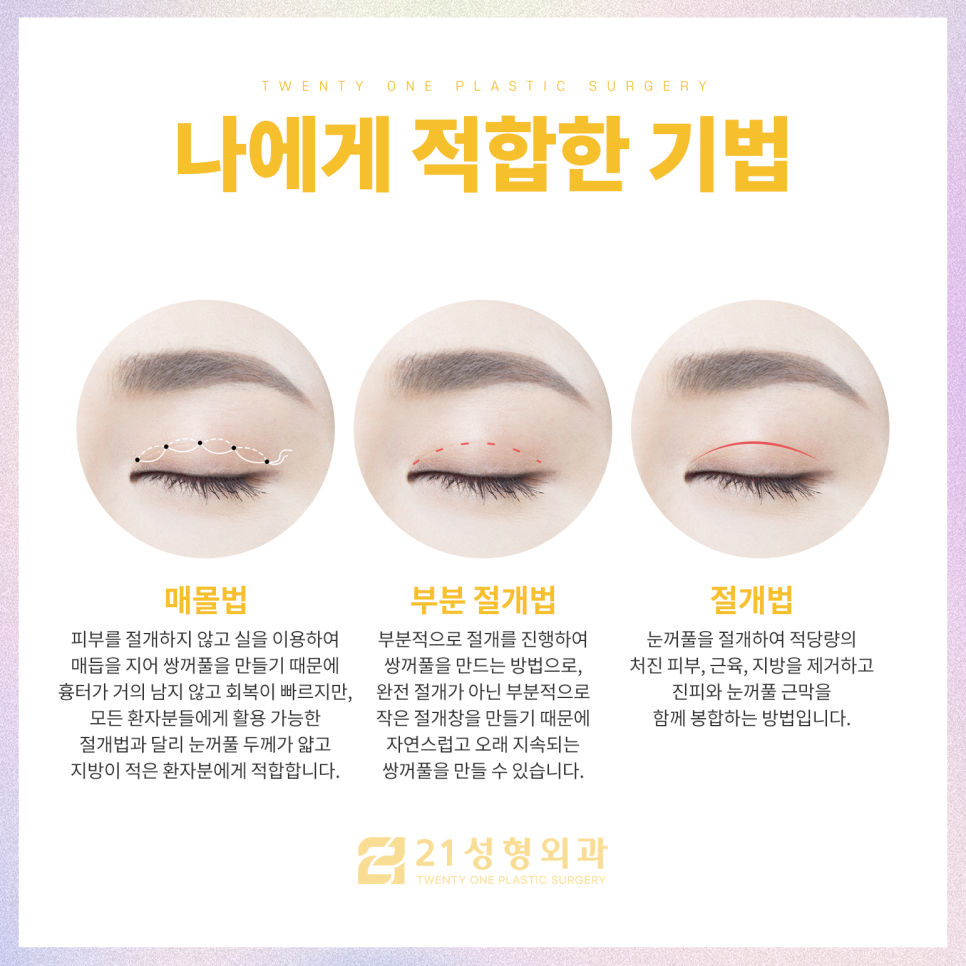 강남쌍꺼풀수술잘하는곳 찾아보는 포인트 관련 이미지 3