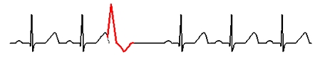 마크로라이드(macrolides) 항생제 ② 관련 이미지 8