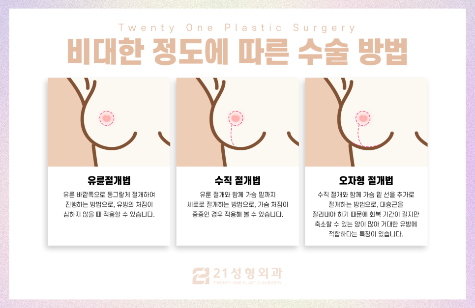 가슴축소술, 가슴의 모양까지 생각해야하는이유 관련 이미지 5