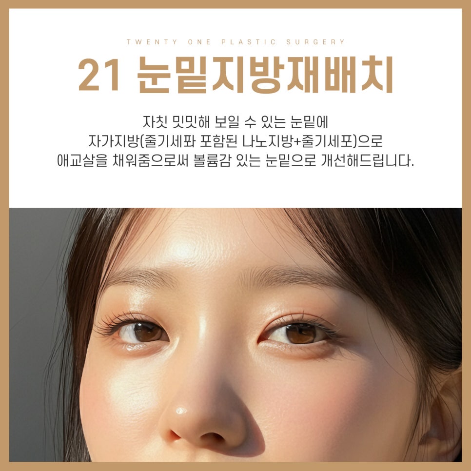 애교살수술은 나노펫 지방이식으로 해결 관련 이미지 4