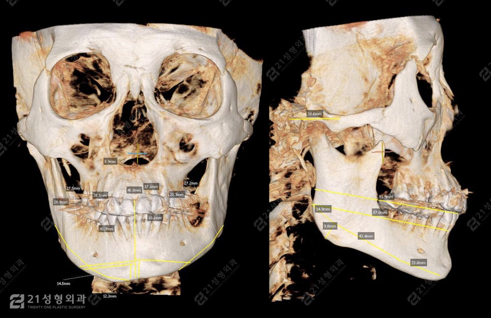 Is a Small Face and a Slim Face Shape Like Jennie’s Really Possible? image 3