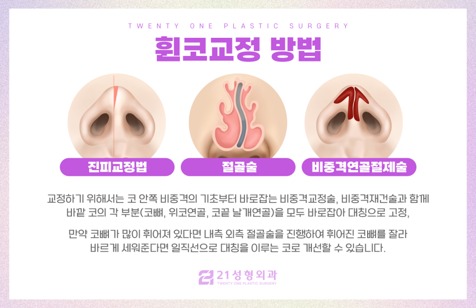 휜코성형 기능적인 문제까지 체크하면 관련 이미지 5